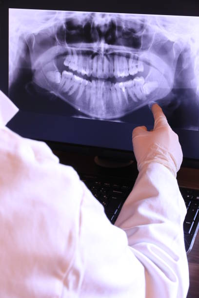 Best Emergency Root Canal Treatment in Denison, TX