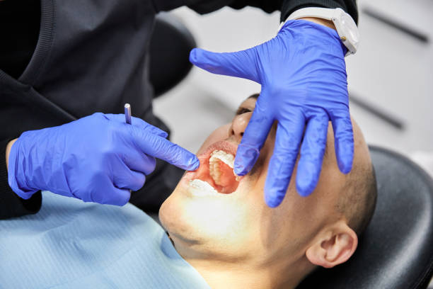 Best Emergency Dental Care for Abscessed Tooth in Denison, TX