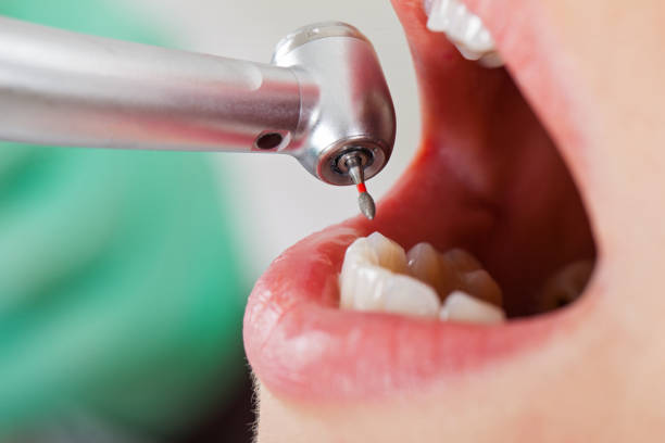 Best Mobile Emergency Dentist in Denison, TX